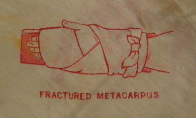 Illustrated triangular bandage